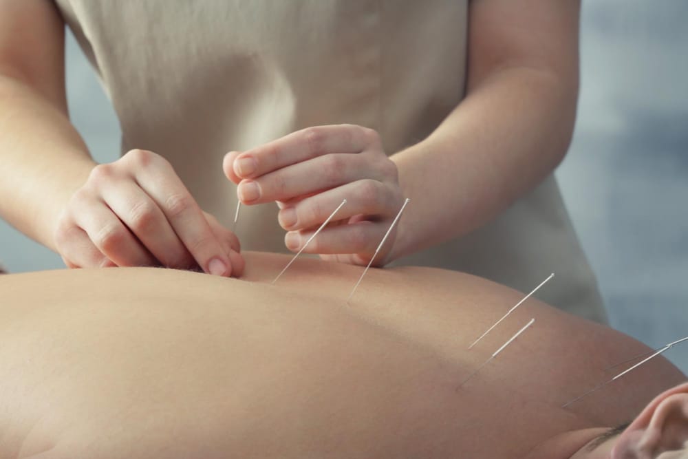 acupuncture à boucherville sur la rive sud
