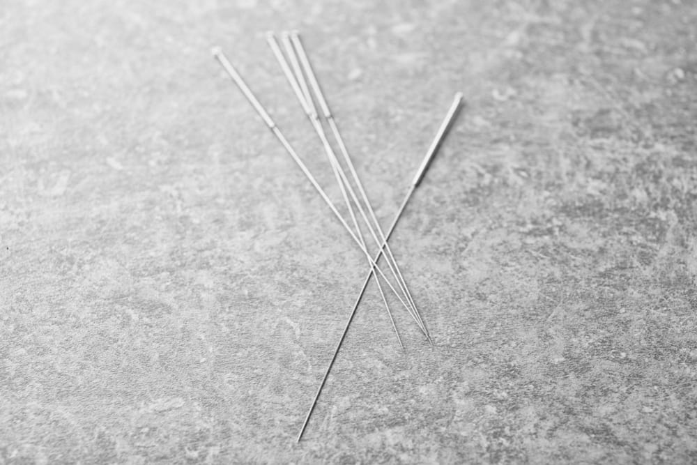aiguilles d'acupuncture sur la rive-sud de montréal